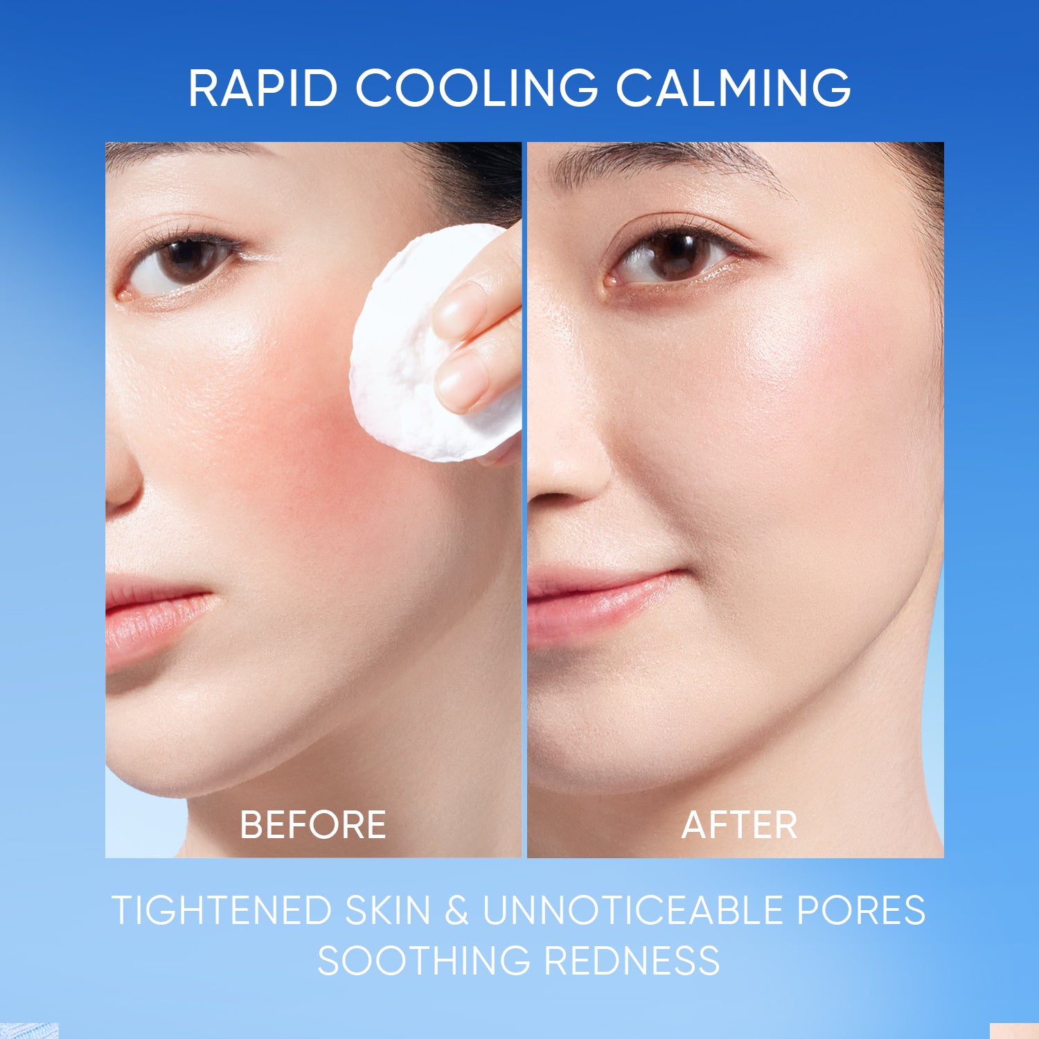 SKIN COOLING SPRAY PAD