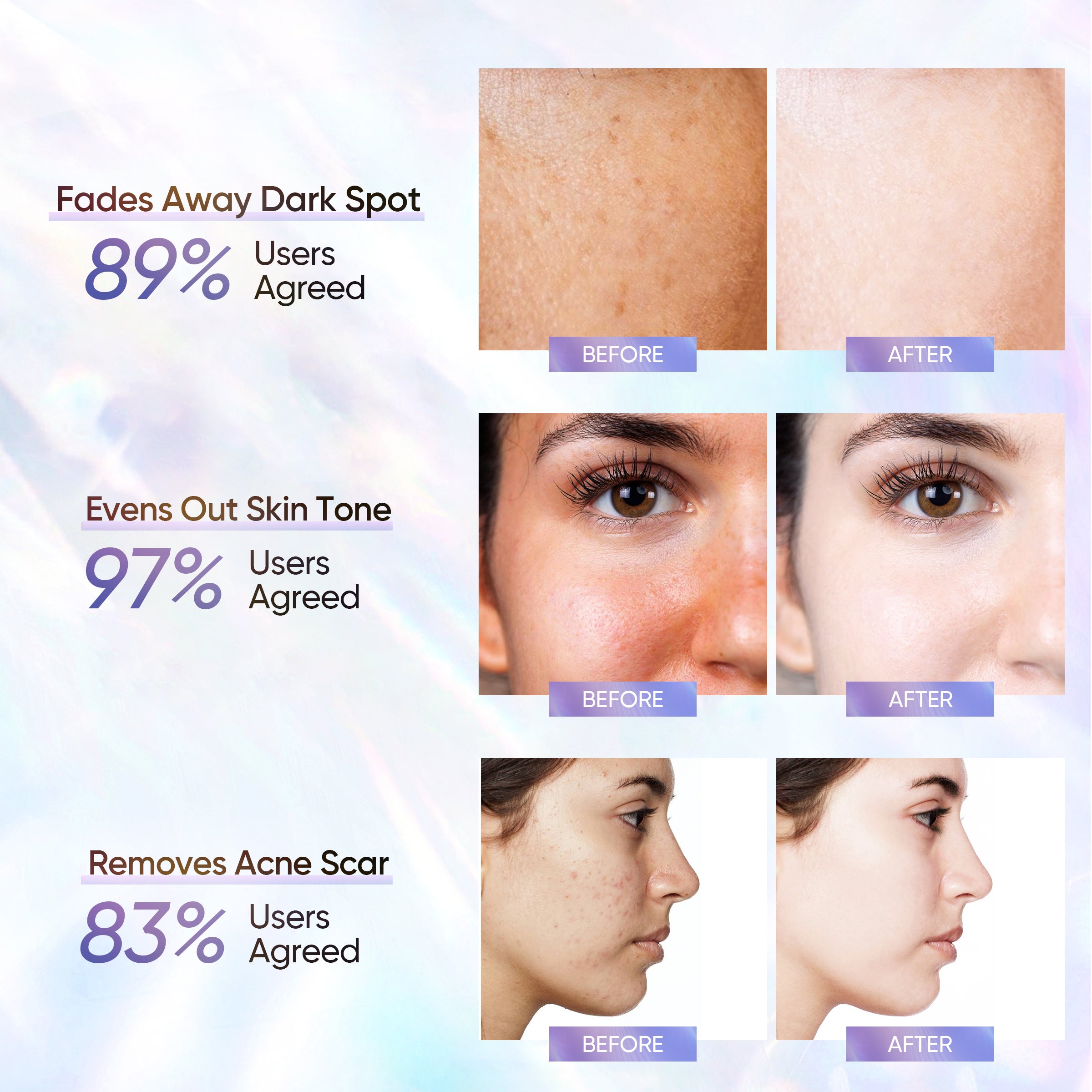 10% Niacinamide Brightening Serum