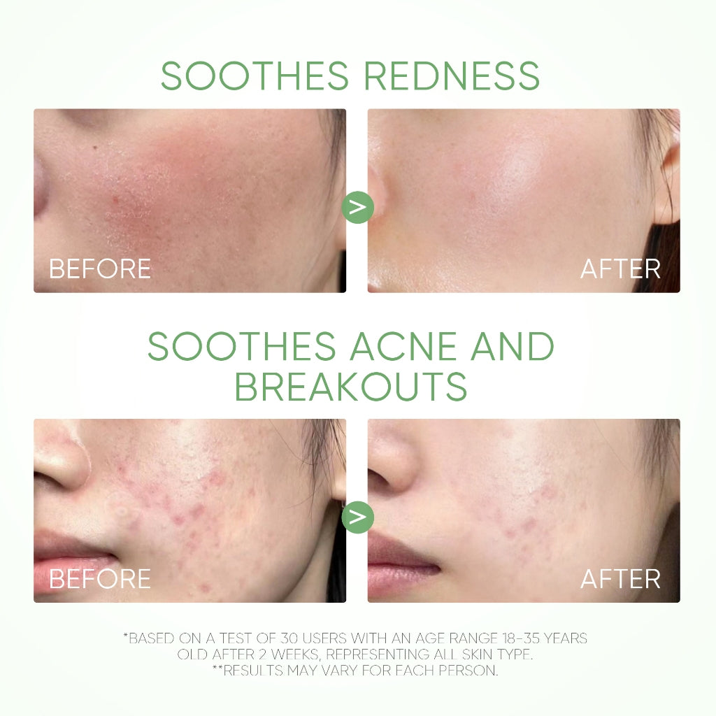 Mugwort Anti Pores & Acne Clay Mask Stick